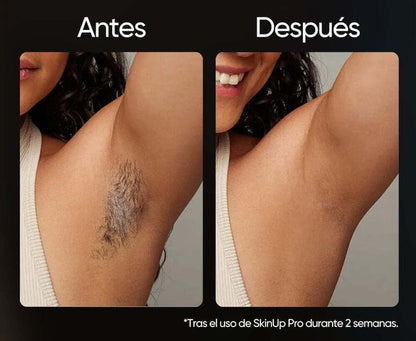 Depiladora SkinUp Pro