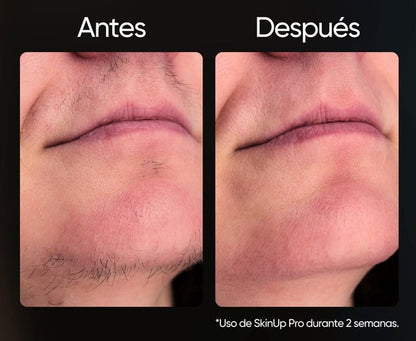 Depiladora SkinUp Pro